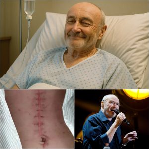 GOOD NEWS from Phil Collins: A Heartfelt Message After Surgery…..