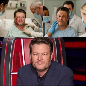 BREAKING: Intruder Attacks Blake Shelton in Home Invasion – Country Legend Seriously Injured, The Initial Cause is Believed To Be… BREAKING: Intruder Attacks Blake Shelton in Home Invasion – Country Legend Seriously Injured, The Initial Cause is Believed To Be…